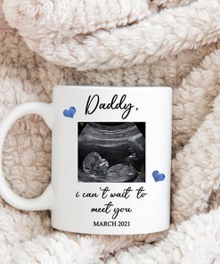 Ultrasound Mug - Dad and Father Mug with Perfect Valentines Day Gift Ideas